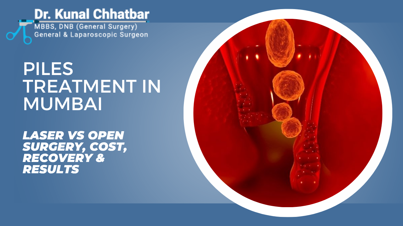 Laparoscopic vs Open Hernia Surgery